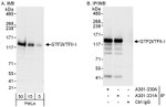 GTF2I/TFII-I Antibody in Western Blot (WB)