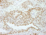 GTF2I/TFII-I Antibody in Immunohistochemistry (IHC)