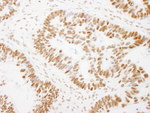 GTF2I/TFII-I Antibody in Immunohistochemistry (IHC)