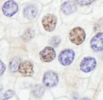 GTF2IRD/TFII-IRD1 Antibody in Immunohistochemistry (IHC)