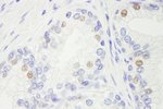 GTF2IRD/TFII-IRD1 Antibody in Immunohistochemistry (IHC)