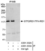 GTF2IRD/TFII-IRD1 Antibody in Immunoprecipitation (IP)