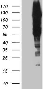 GTF2IRD1 Antibody in Western Blot (WB)