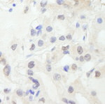 GTF3C1/TFIIIC220 Antibody in Immunohistochemistry (IHC)