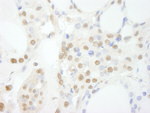 GTF3C3/TFIIIC102 Antibody in Immunohistochemistry (IHC)