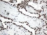 GTF3C4 Antibody in Immunohistochemistry (Paraffin) (IHC (P))