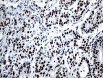 GTF3C4 Antibody in Immunohistochemistry (Paraffin) (IHC (P))