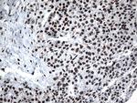 GTF3C4 Antibody in Immunohistochemistry (Paraffin) (IHC (P))