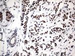 GTF3C4 Antibody in Immunohistochemistry (Paraffin) (IHC (P))