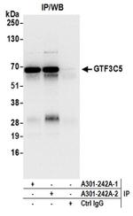 GTF3C5/TFIIIC63 Antibody in Western Blot (WB)