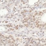 GTF3C5/TFIIIC63 Antibody in Immunohistochemistry (IHC)