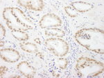 GTF3C5/TFIIIC63 Antibody in Immunohistochemistry (IHC)