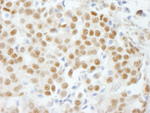 GTF3C5/TFIIIC63 Antibody in Immunohistochemistry (IHC)