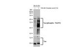 Phospo-Tau (Thr217) Antibody in Western Blot (WB)