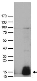 GUCA2A Antibody in Western Blot (WB)