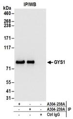 GYS1 Antibody in Western Blot (WB)