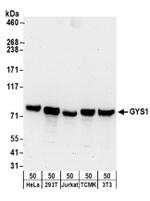 GYS1 Antibody in Western Blot (WB)