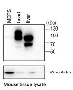 GYS2 Antibody in Western Blot (WB)