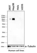 GYS2 Antibody in Western Blot (WB)