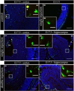 Galectin 3 Antibody in Immunohistochemistry (IHC)