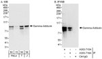 Gamma-Adducin Antibody in Western Blot (WB)