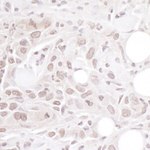 Geminin Antibody in Immunohistochemistry (IHC)