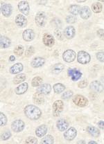 Geminin Antibody in Immunohistochemistry (IHC)