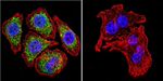 Glucocorticoid Receptor alpha Antibody in Immunocytochemistry (ICC/IF)