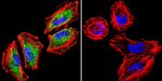 Glucocorticoid Receptor Antibody in Immunocytochemistry (ICC/IF)