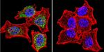 Glucocorticoid Receptor Antibody in Immunocytochemistry (ICC/IF)