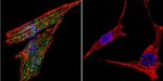 Glucocorticoid Receptor Antibody in Immunocytochemistry (ICC/IF)