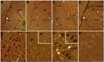 NR3C2 Antibody in Immunohistochemistry (IHC)