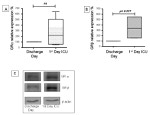 Glucocorticoid Receptor beta Antibody in Western Blot (WB)