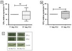 Glucocorticoid Receptor beta Antibody in Western Blot (WB)