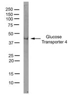 GLUT4 Antibody in Western Blot (WB)