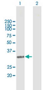 NAT1 Antibody in Western Blot (WB)