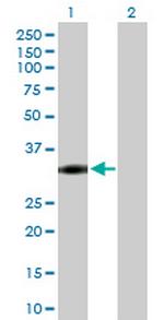 NAT1 Antibody in Western Blot (WB)