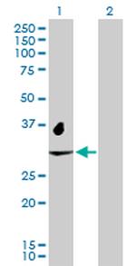 NAT2 Antibody in Western Blot (WB)