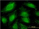 ABCF1 Antibody in Immunocytochemistry (ICC/IF)