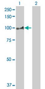 ABP1 Antibody in Western Blot (WB)