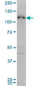 ABL2 Antibody in Western Blot (WB)