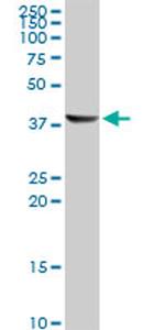 ACAA1 Antibody in Western Blot (WB)