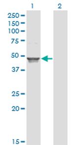 ACAA1 Antibody in Western Blot (WB)