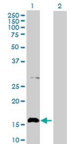 ACP1 Antibody in Western Blot (WB)