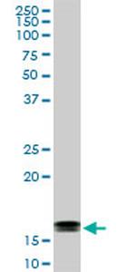 ACP1 Antibody in Western Blot (WB)