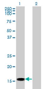 ACP1 Antibody in Western Blot (WB)