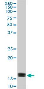 ACP1 Antibody in Western Blot (WB)