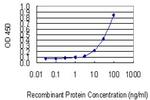 ACP2 Antibody in ELISA (ELISA)