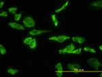 ACP2 Antibody in Immunocytochemistry (ICC/IF)