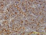 ACP2 Antibody in Immunohistochemistry (Paraffin) (IHC (P))